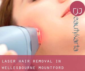 Laser Hair removal in Wellesbourne Mountford