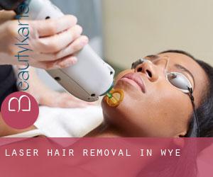 Laser Hair removal in Wye