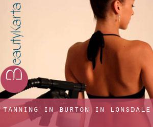 Tanning in Burton in Lonsdale
