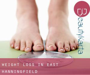 Weight Loss in East Hanningfield