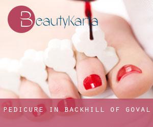 Pedicure in Backhill of Goval