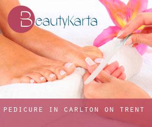 Pedicure in Carlton on Trent