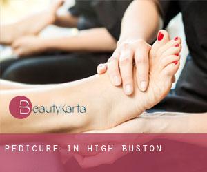 Pedicure in High Buston